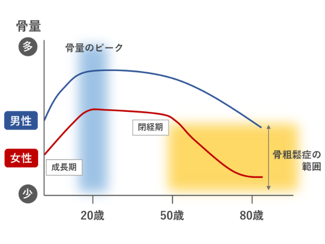 年齢に伴う骨量の変化を示した図。男女ともに20歳前後に骨量はピークに達し、50歳前後から減少していく様子がわかる。特に女性は閉経後、急激に骨量が減少する様子がわかる。