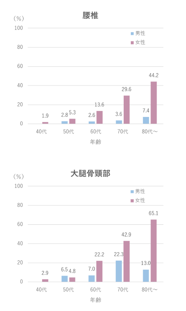 骨粗鬆症の有病率を年代別に示した図。特に女性は年齢が上がるにつれて骨粗鬆症の有病率が上がっている。80代では、腰椎の診断で44.2%、大腿骨頸部の診断で65.1%もの女性が骨粗鬆症を有していると推計されている。